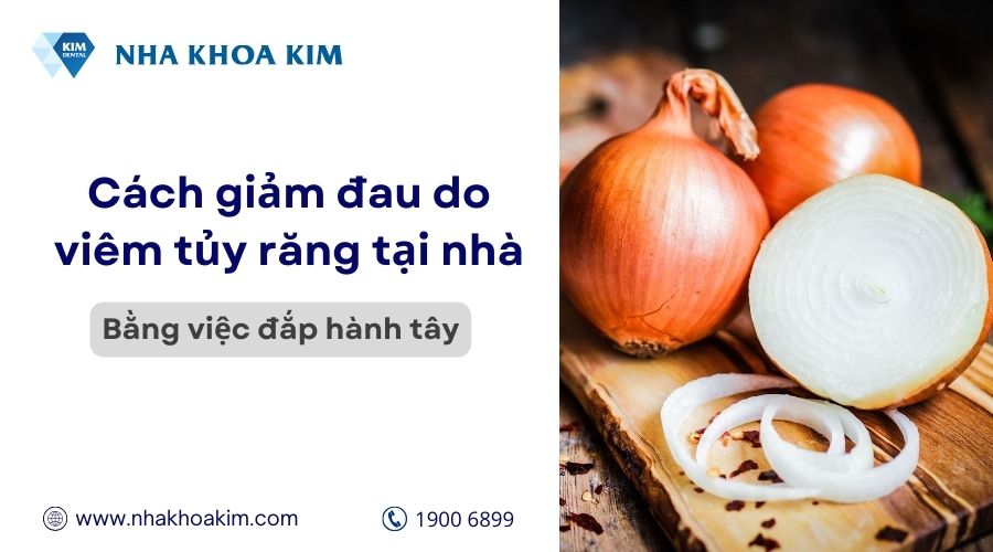 cách làm chết tủy răng tại nhà bằng hành tây