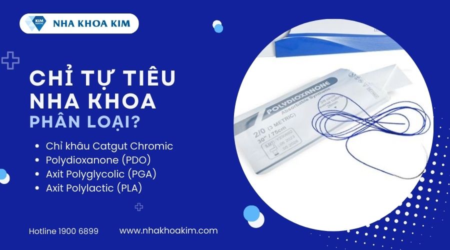phân loại chỉ tự tiêu