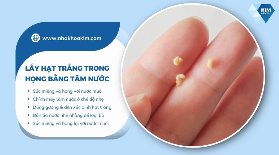 Cách lấy hạt trắng trong họng bằng tăm nước