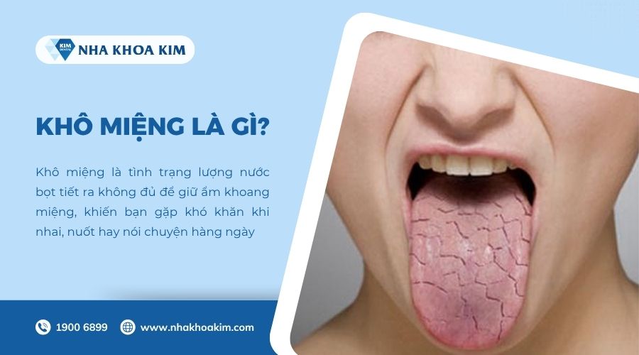 Khô miệng là gì