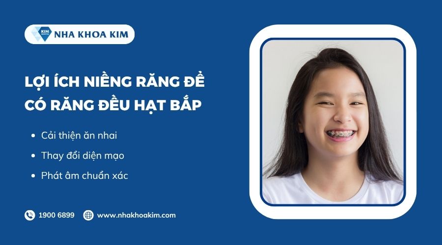 Lợi ích niềng răng để có hàm răng đều hạt bắp