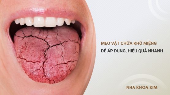 Các mẹo vặt chữa khô miệng dễ áp dụng, hiệu quả nhanh chóng