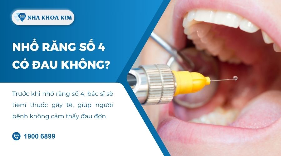 Nhổ răng số 4 có đau không?
