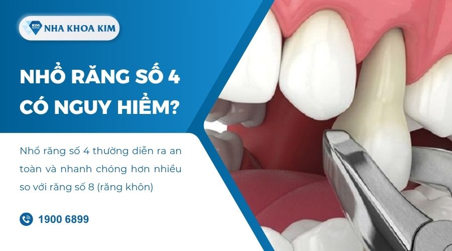 Nhổ răng số 4 có nguy hiểm không