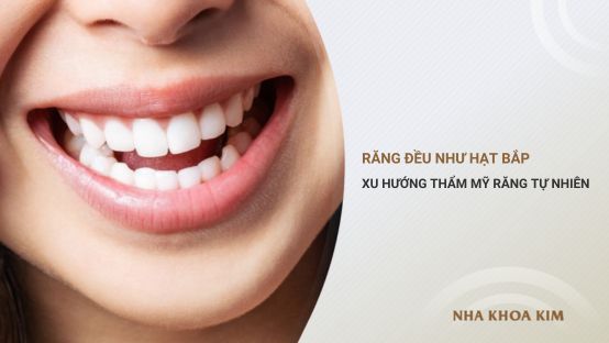 Răng đều như hạt bắp: Xu hướng thẩm mỹ răng tự nhiên mới