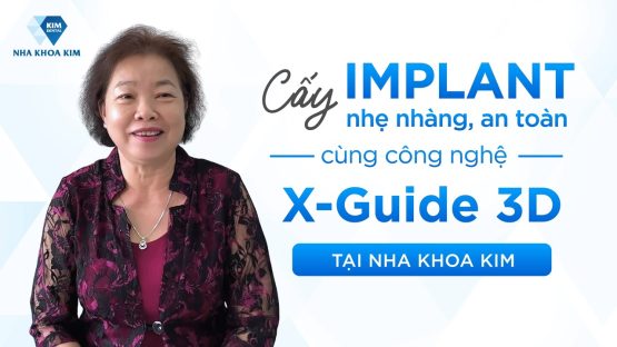 Cấy Ghép Implant An Toàn Tuyệt Đối Với Công Nghệ Robot X-Guide 3D