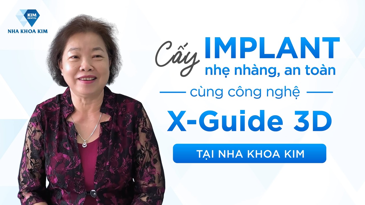 Cấy Ghép Implant Nhẹ Nhàng Và An Toàn Tuyệt Đối Với Công Nghệ Robot X-Guide 3D Độc Quyền