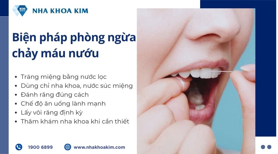 Biện pháp phòng ngừa chảy máu lợi