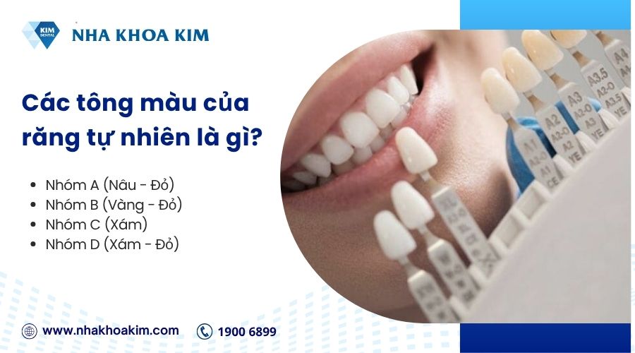 Các tông màu của răng tự nhiên là gì?