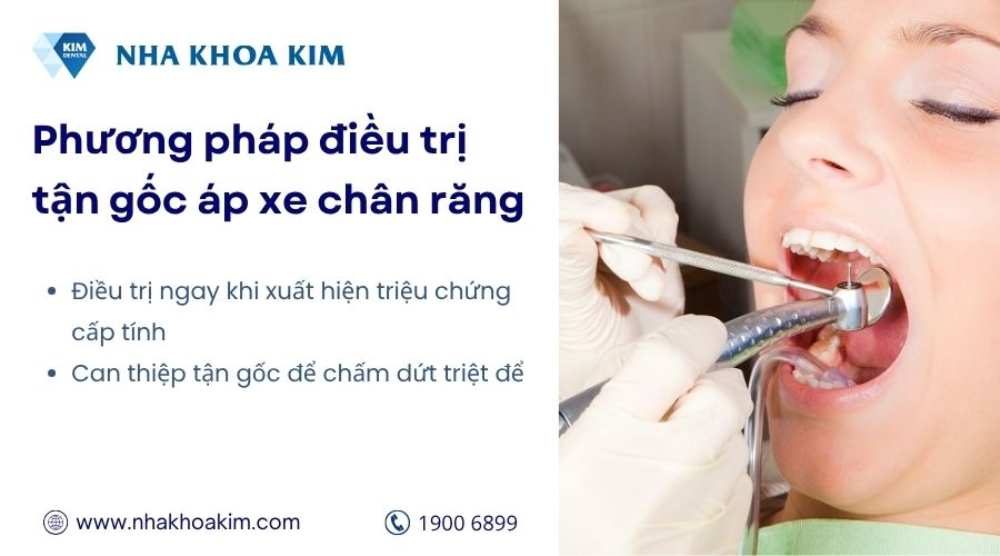 Điều trị tận gốc áp xe chân răng