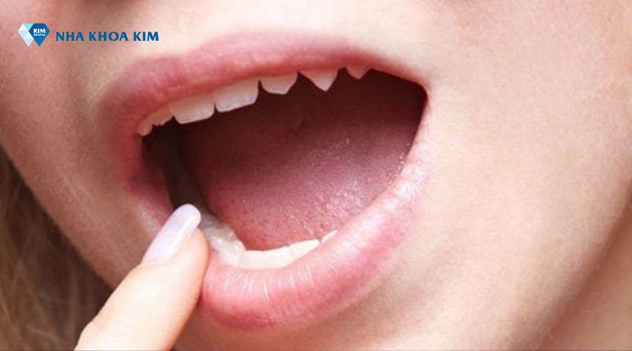 Màu lưỡi bình thường cho thấy sức khỏe ổn định