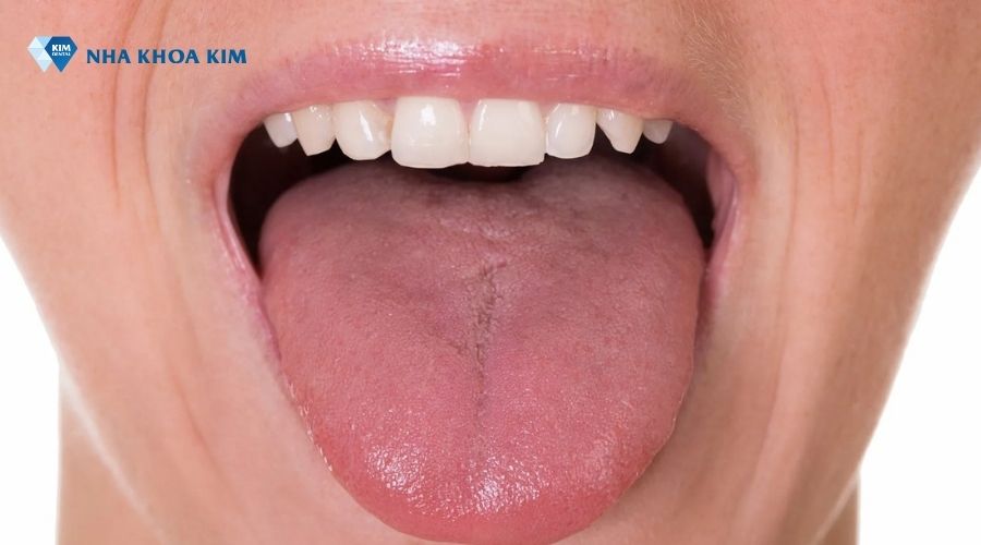 Hình ảnh lưỡi khỏe mạnh ở người bình thường