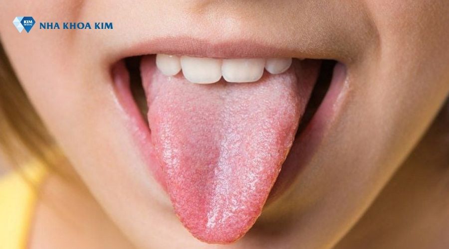 Lưỡi khỏe mạnh, đều màu