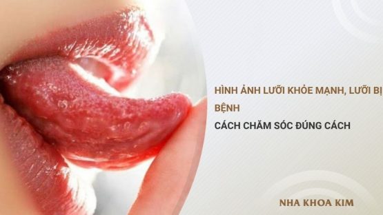 Hình ảnh lưỡi khỏe mạnh, lưỡi bệnh và cách chăm sóc đúng cách