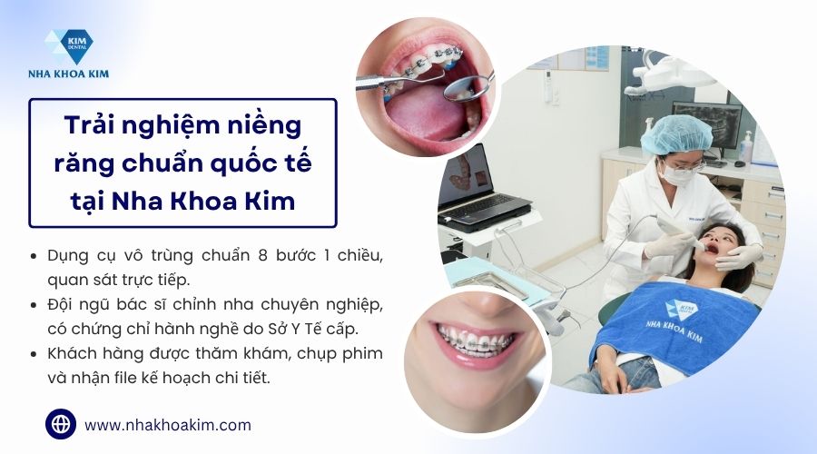 Mắc cài tự buộc và mắc cài thường chuẩn tại Nha Khoa Kim