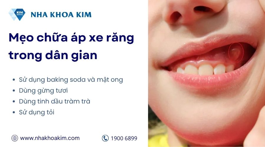 Mẹo dân gian chữa áp xe răng