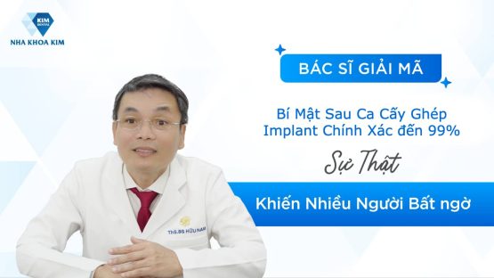 Bí Mật Sau Ca Cấy Ghép Implant Chính Xác đến 99%
