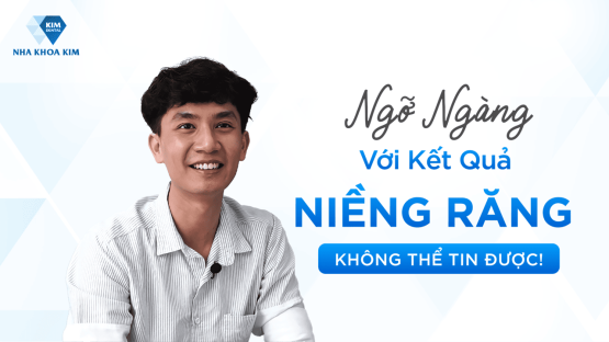 Cận Cảnh Kết Quả Sau Khi Niềng Răng Khiến Duy Phương Ngỡ Ngàng