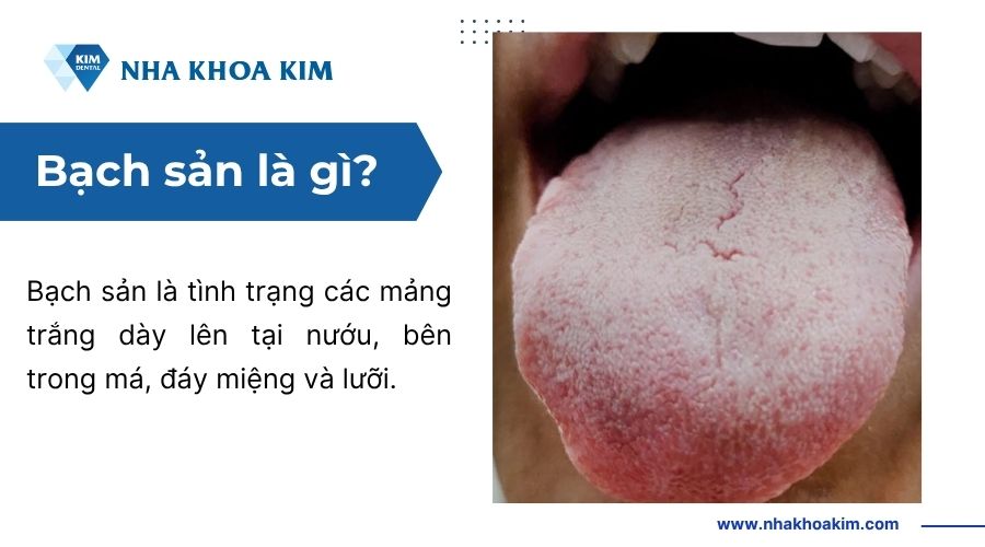 Bạch sản là gì?
