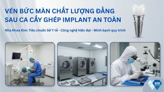 Vén bức màn chất lượng đằng sau một ca cấy răng Implant an toàn
