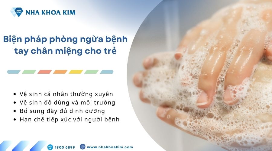 Biện pháp phòng ngừa bệnh tay chân miệng cho trẻ