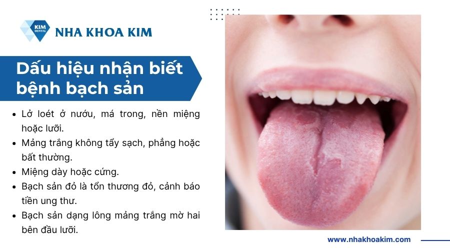 Dấu hiệu nhận biết bệnh bạch sản