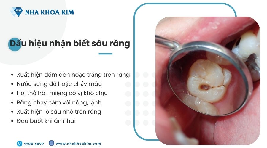Dấu hiệu nhận biết sâu răng