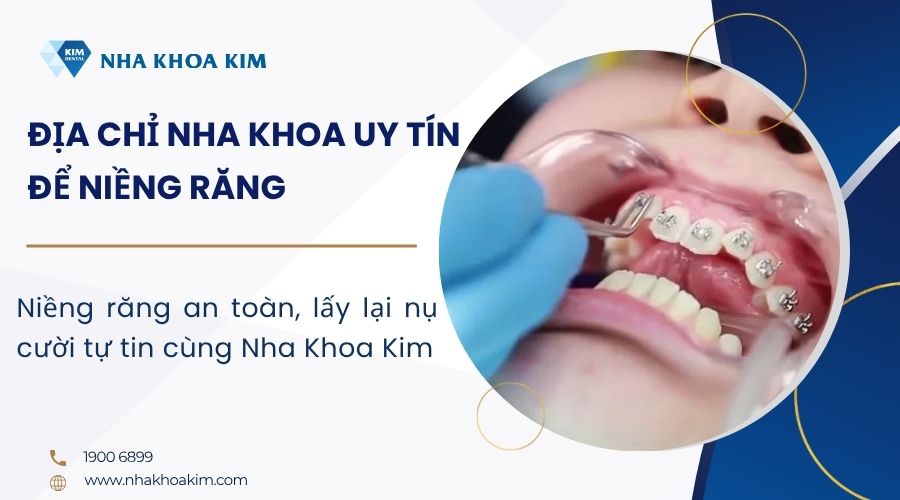 Lựa chọn địa chỉ nha khoa uy tín để niềng răng