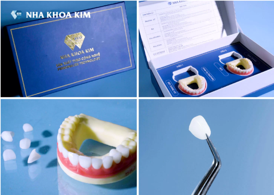 Màu sắc và chất lượng răng sứ tại nhà máy răng sứ của Nha Khoa Kim đạt được độ bền đẹp, tự nhiên như răng thật