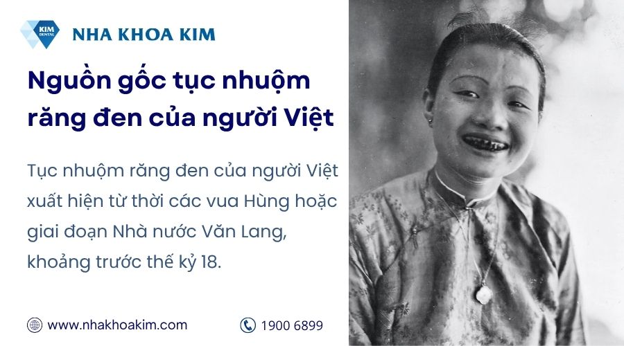 Nguồn gốc của tục nhuộm răng đen