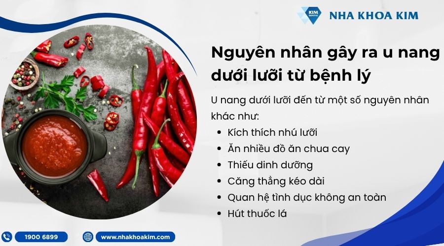 Nguyên nhân khác gây nên bệnh u nang dưới lưỡi