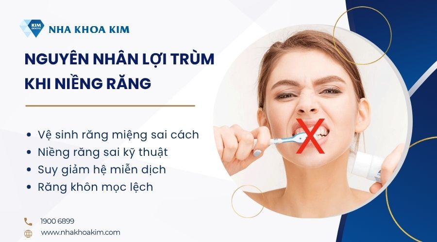Nguyên nhân khiến lợi trùm khi niềng răng