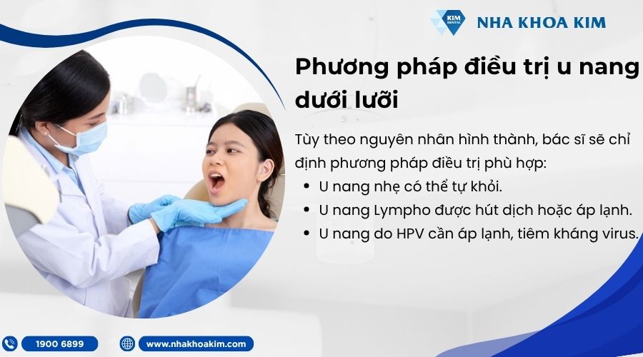 Phương pháp điều trị u nang dưới lưỡi