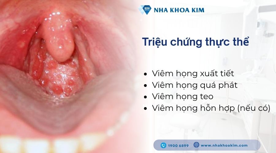 Triệu chứng thực thể dấu hiệu của bệnh viêm họng mãn tính