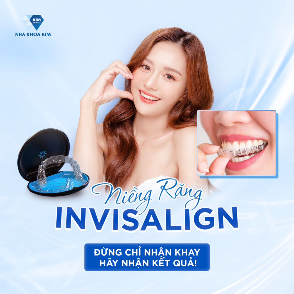 Ưu điểm của niềng răng trong suốt