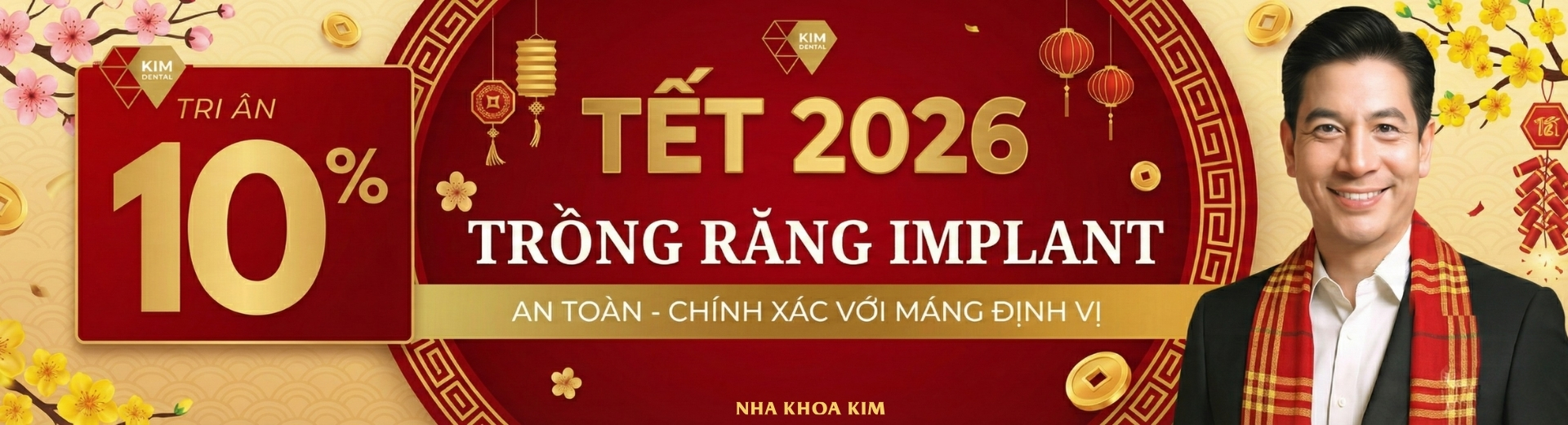 Tri ân 10% dịch vụ trồng răng implant