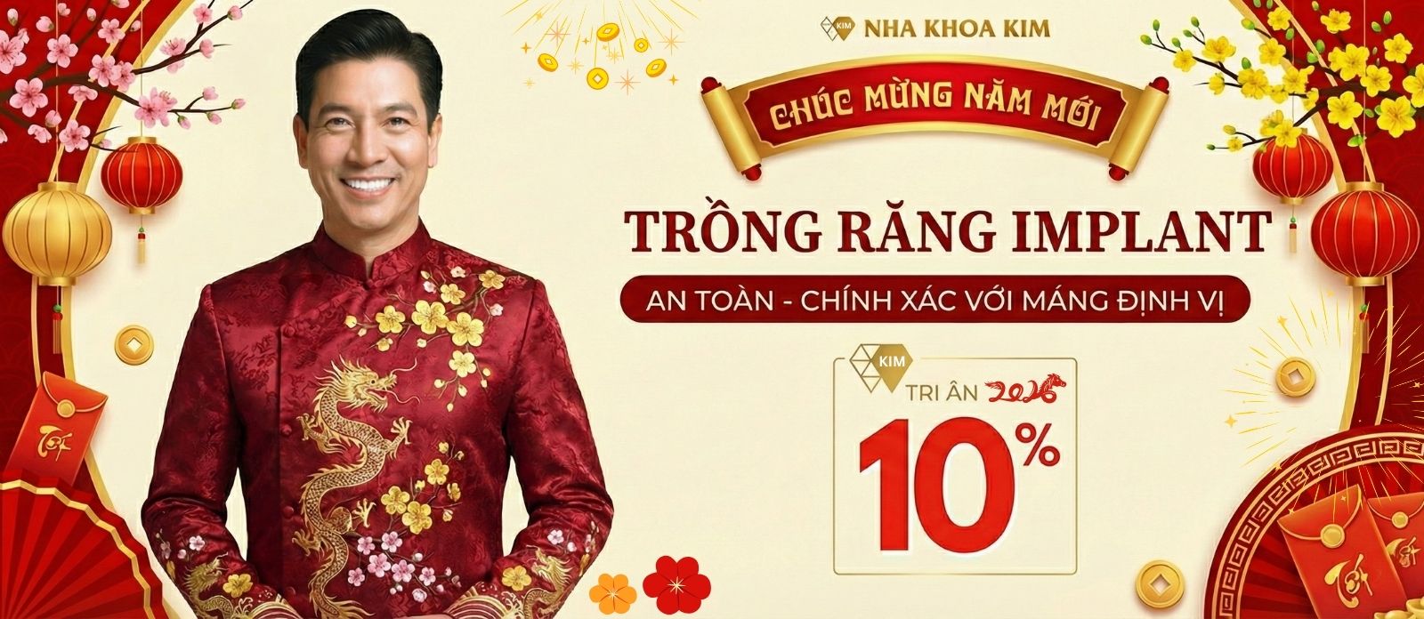 Tri ân 10% dịch vụ trồng răng implant