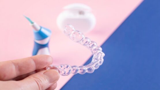 So sánh niềng răng eCligner và Invisalign – Nên chọn loại nào?
