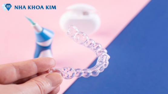 So sánh niềng răng eCligner và Invisalign – Nên chọn loại nào?