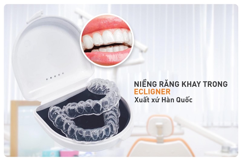Hình ảnh niềng răng eCligner