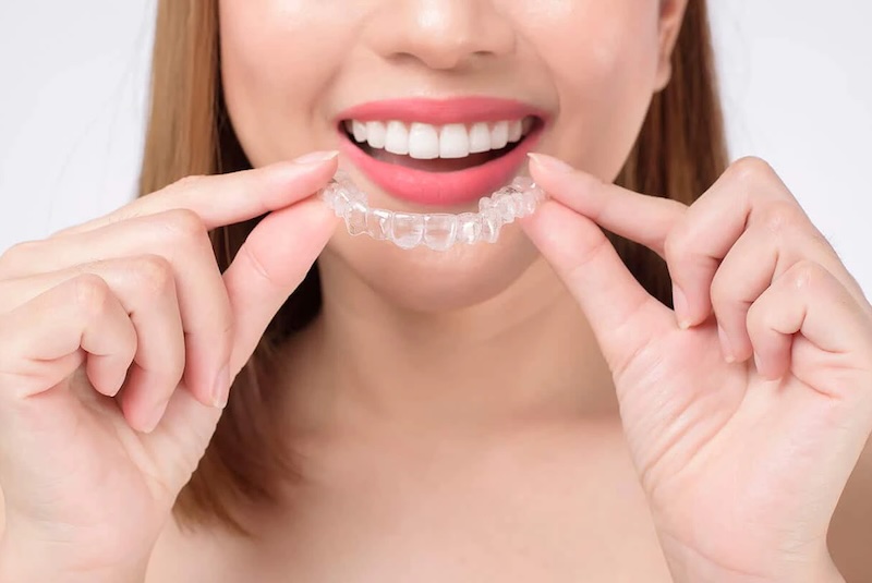 Lựa chọn niềng răng eCligner hay Invisalign phụ thuộc vào nhiều yếu tố