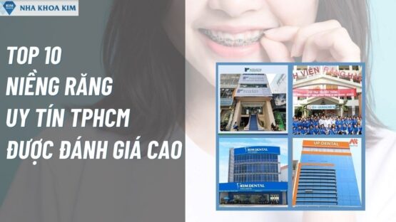 Top 10 Niềng Răng Uy Tín TPHCM Được Đánh Giá Cao
