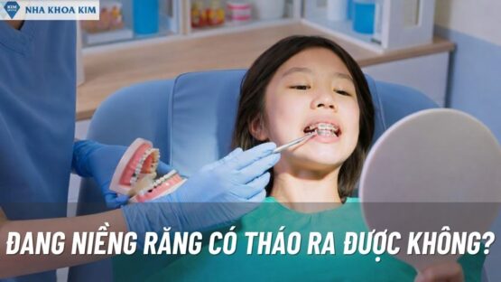 Đang Niềng Răng Tháo Ra Được Không? Giải Đáp Chi Tiết