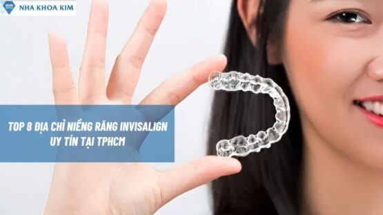 Top 8 Địa Chỉ Niềng Răng Invisalign Uy Tín Tại TPHCM