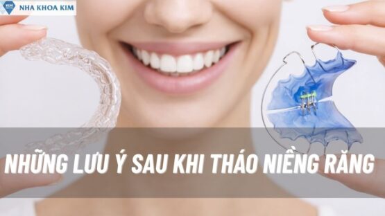 Lưu Ý Khi Tháo Niềng Răng – Điều Cần Biết Để Giữ Răng Đẹp