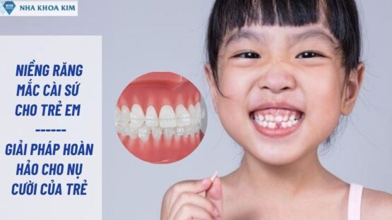 Niềng Răng Mắc Cài Sứ Cho Trẻ Em An Toàn, Đẹp Tự Nhiên