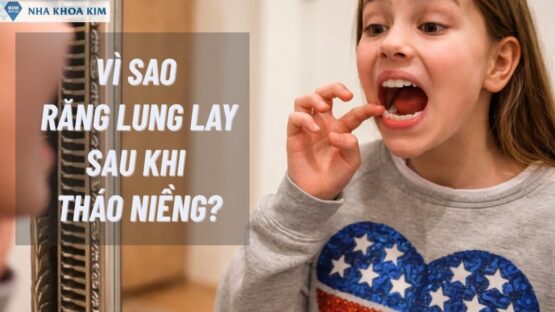 Vì Sao Răng Lung Lay Sau Khi Tháo Niềng? Những Điều Lưu Ý