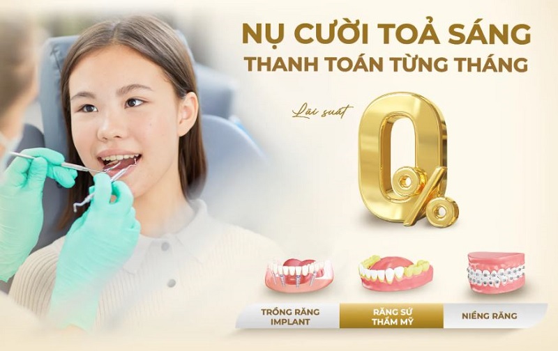 Nha khoa Vsita Dental là địa chỉ nha khoa uy tín tại TP.HCM
