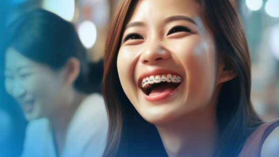 Bầu có niềng răng hô được không? Giải đáp chi tiết