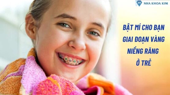 Bật Mí Cho Bạn Giai Đoạn Vàng Niềng Răng Ở Trẻ